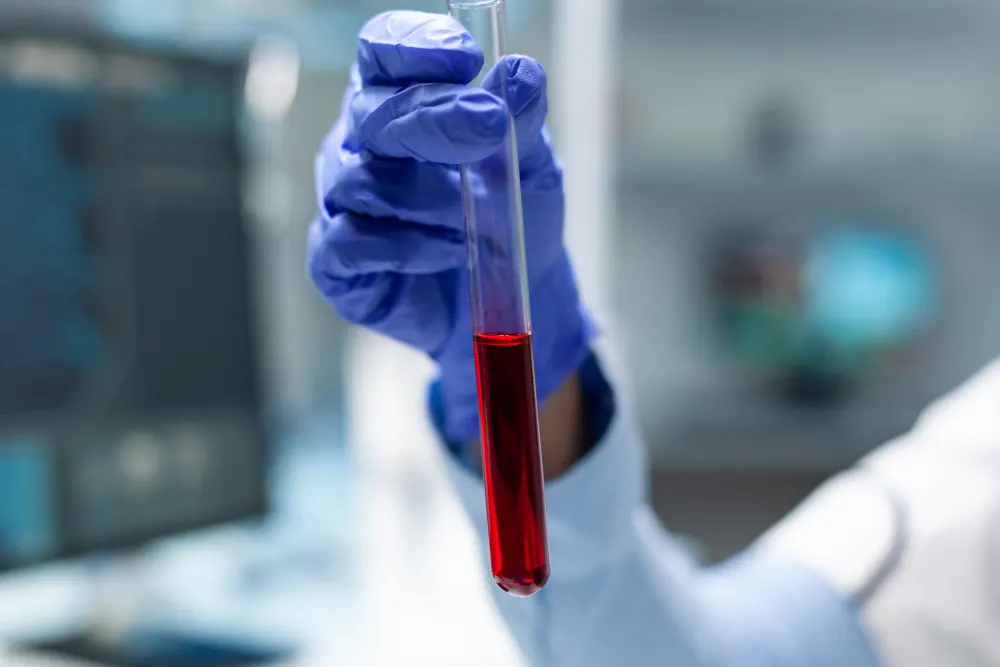 Blood Type Test Pack